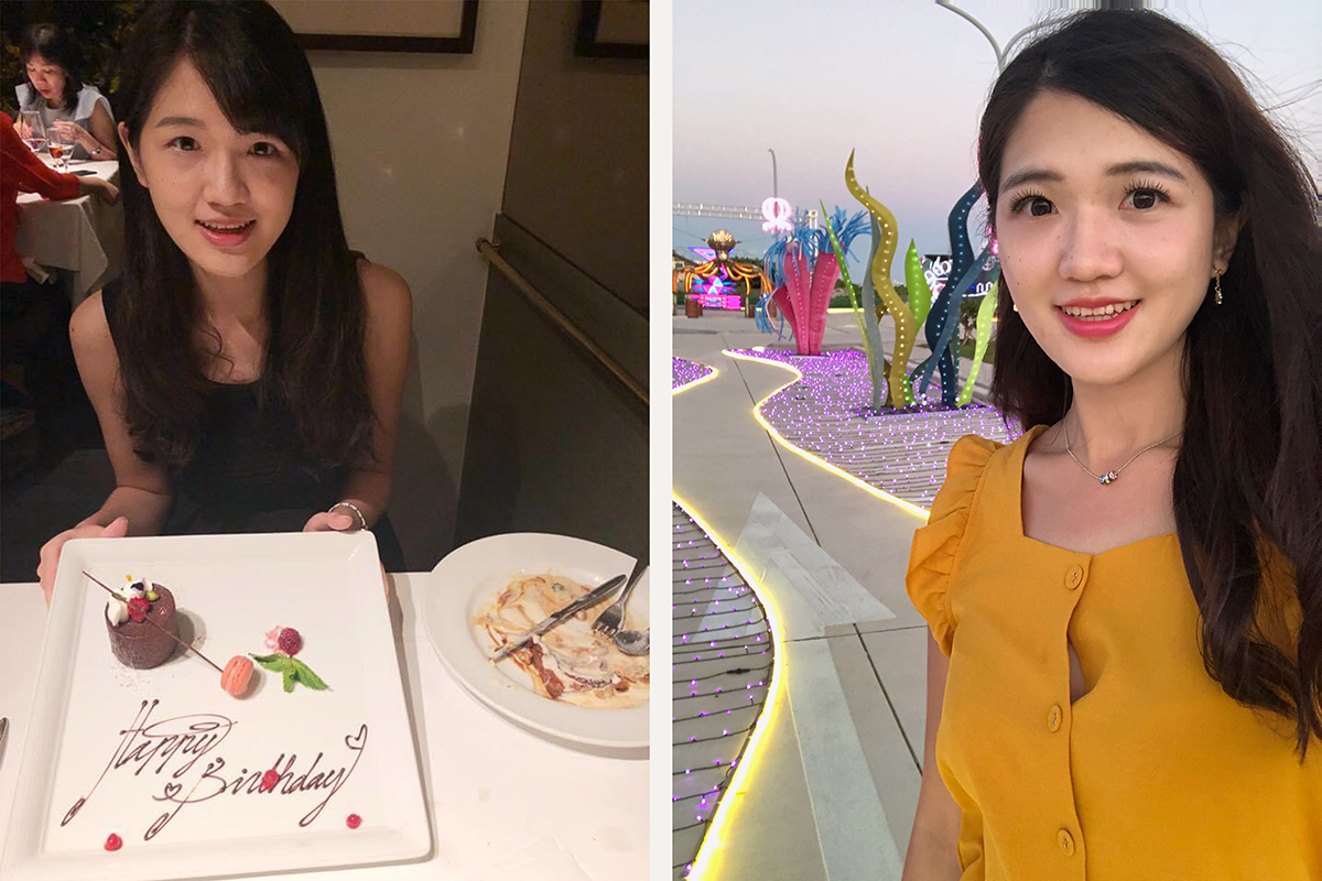 玻尿酸淚溝.眼袋.