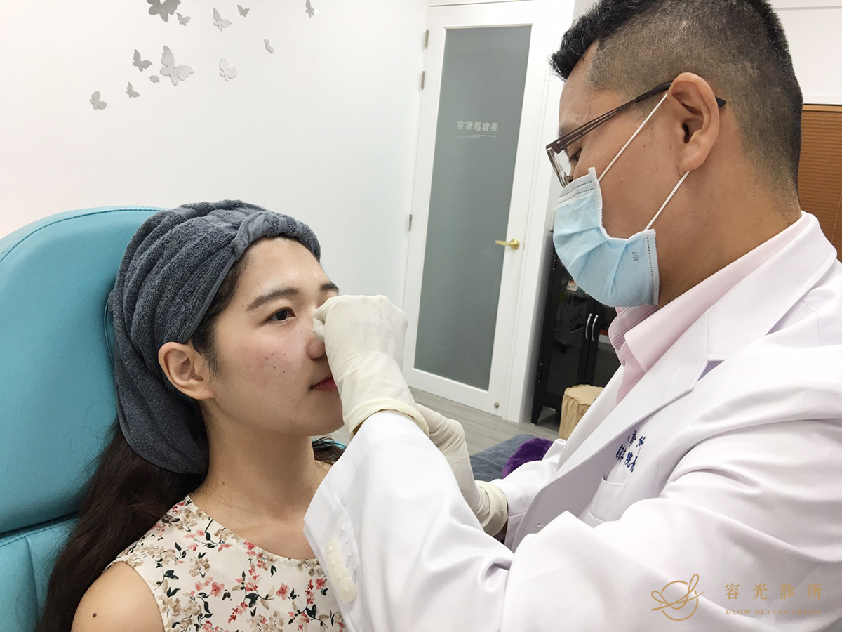 玻尿酸淚溝.眼袋.周建存醫師.存奕美學診所