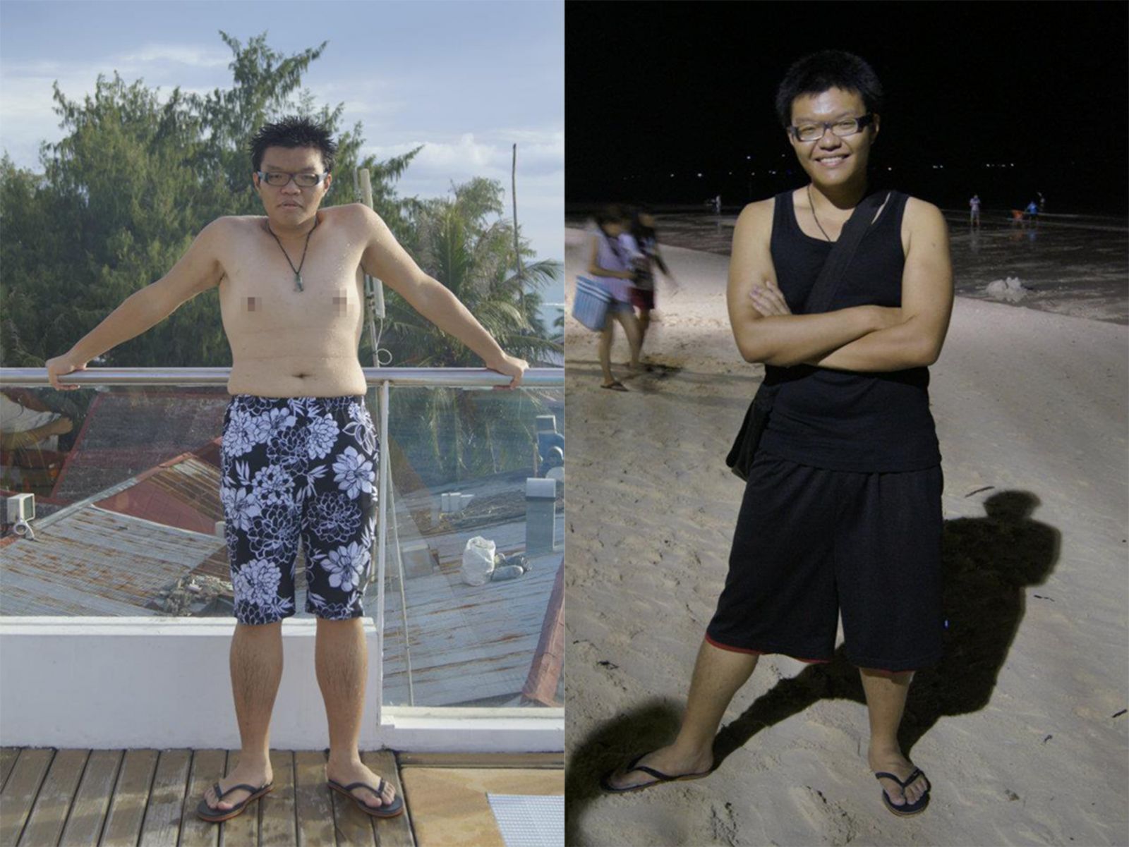 存奕美學診所.桃園減重.桃園減重推薦.周建存醫師