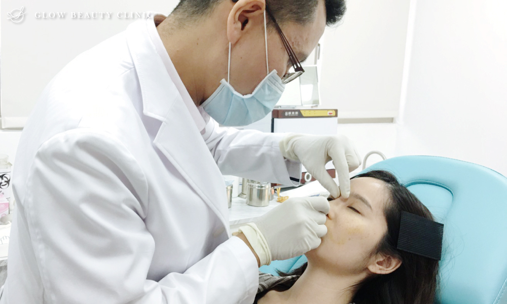 埋線隆鼻.周建存院長.存奕美學.6D鼻雕