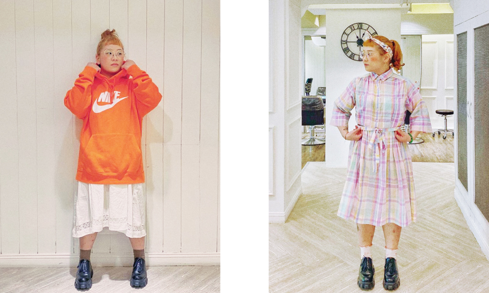 多囊性卵巢症候群.肥胖.瘦身.容光診所.存奕美學診所.周建存醫師